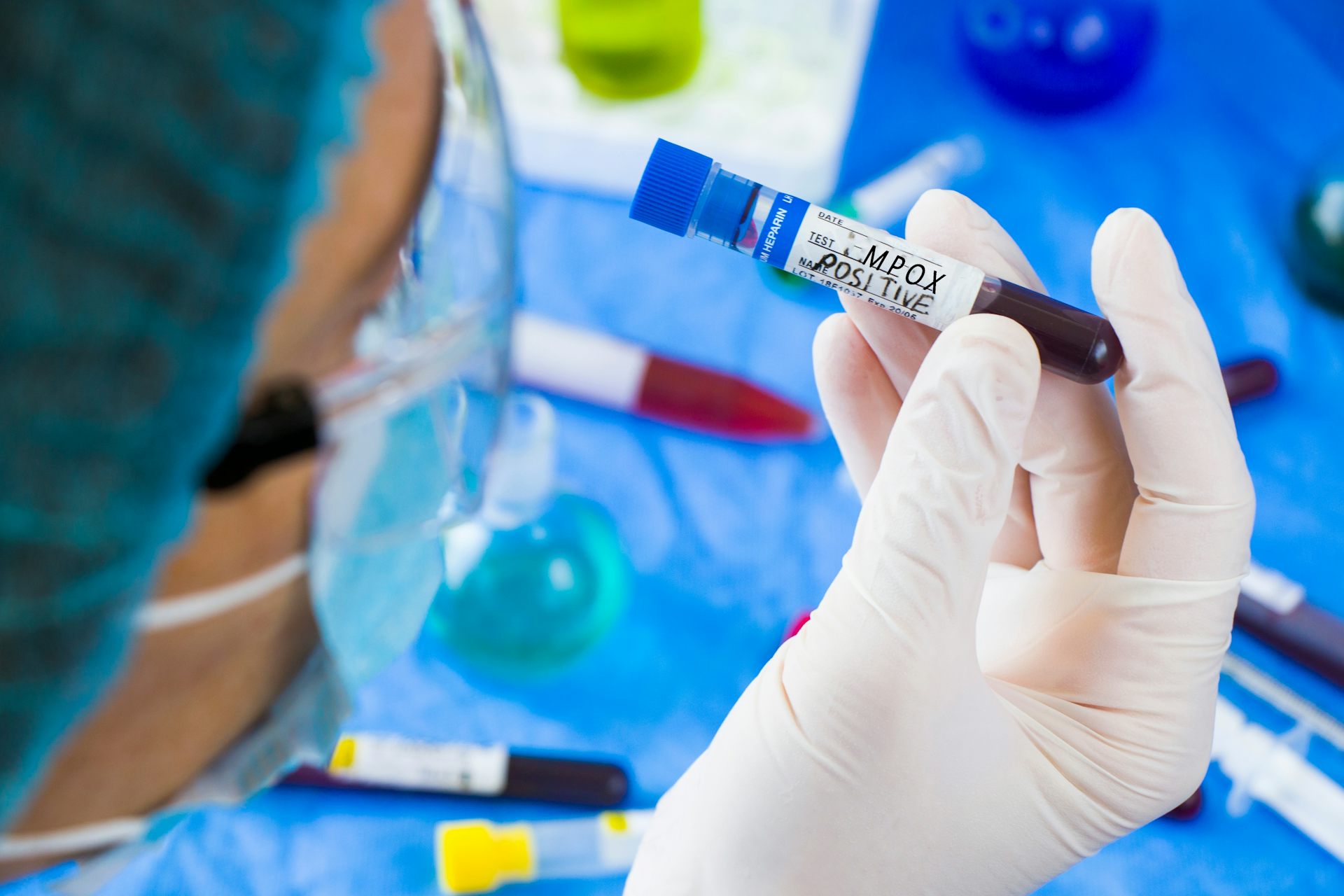 Control y prevención, claves en la infección por mpox