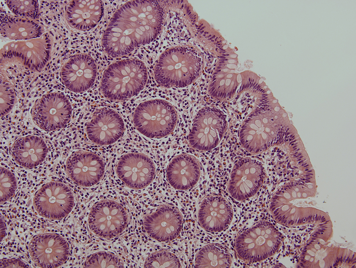 Una investigación del IBiS revela el importante papel de una molécula en el control del VIH en tejido