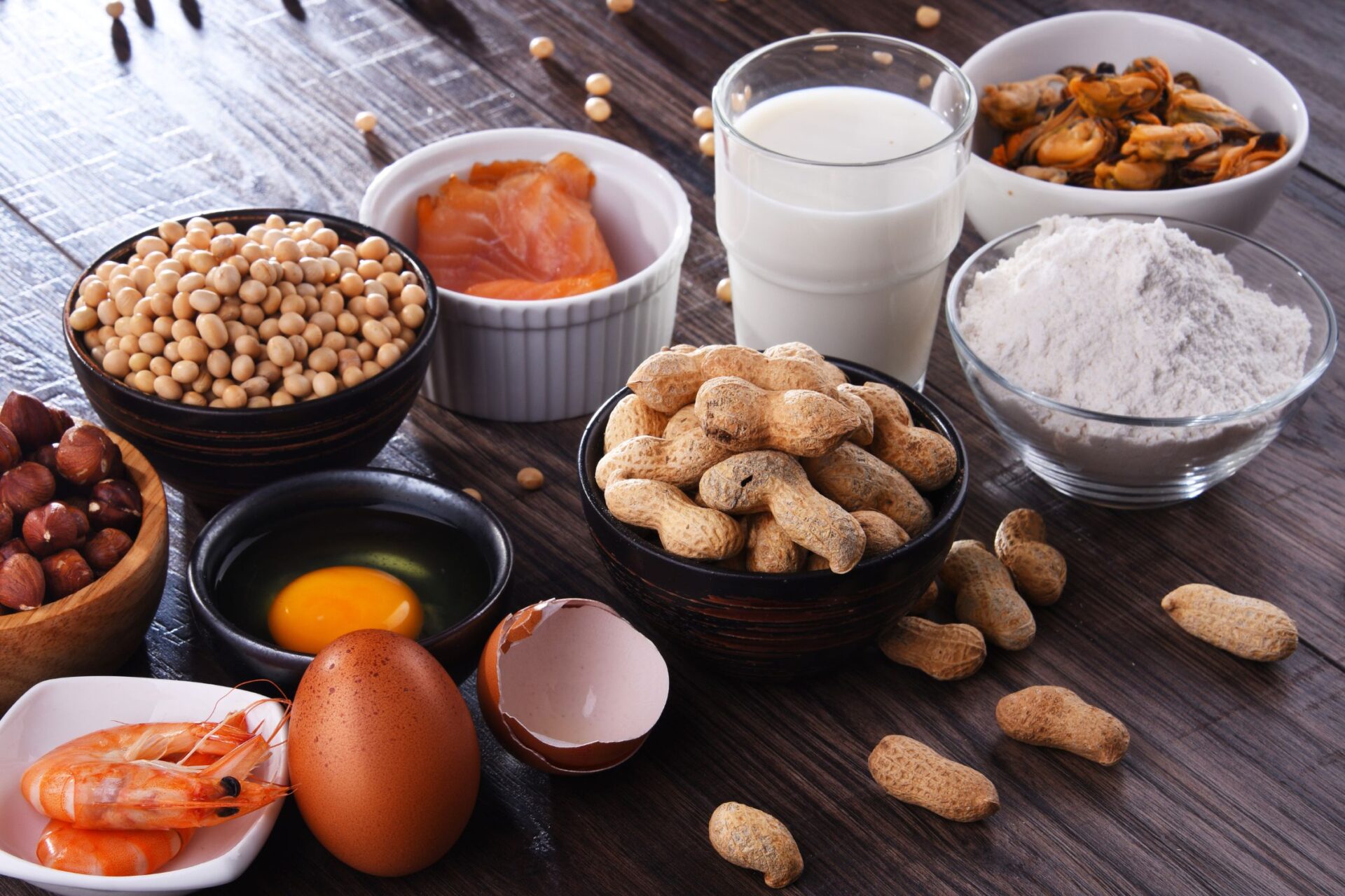 Evita los alérgenos con el mensaje saludable del SACU