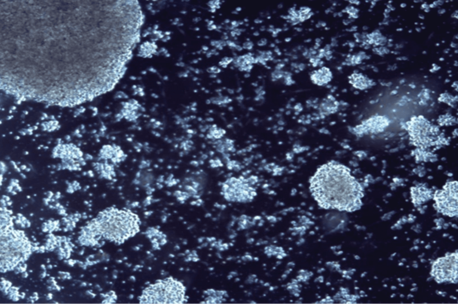 Investigadores del Instituto de Biomedicina de Sevilla desarrollan una nueva terapia para combatir el mieloma múltiple