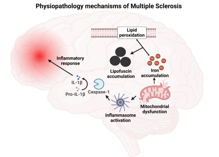 Un estudio identifica nuevos mecanismos celulares en la esclerosis múltiple   Un estudio pionero llevado a cabo por un equipo del del Centro Andaluz de Biología del Desarrollo revela alteraciones clave en la disfunción mitocondrial, el metabolismo del hierro y las rutas de inflamación en células derivadas de pacientes con esta enfermedad