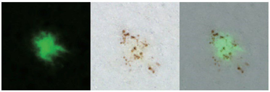 Una investigación del IBiS identifica una nueva diana para el tratamiento del Alzheimer