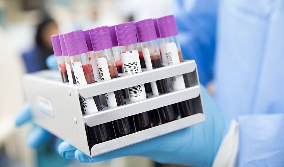1713343096677AnalisisSangre_Estandar.jpg La donación de muestras para la investigación, esencial para conocer más la salud cardiovascular de las mujeres