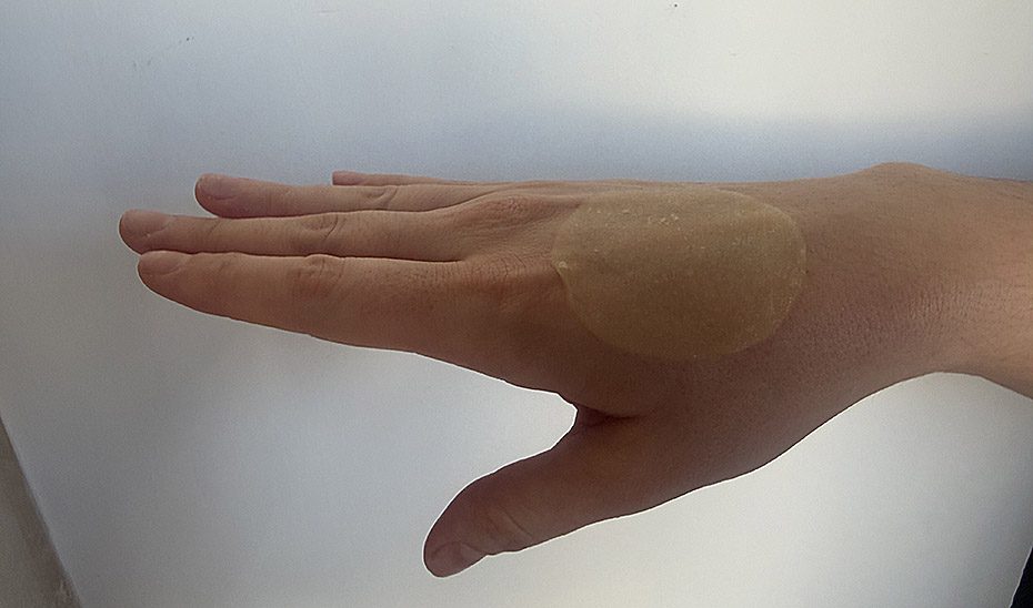 Un vendaje creado con paja y un hongo asiático acelera la cicatrización y combate infecciones