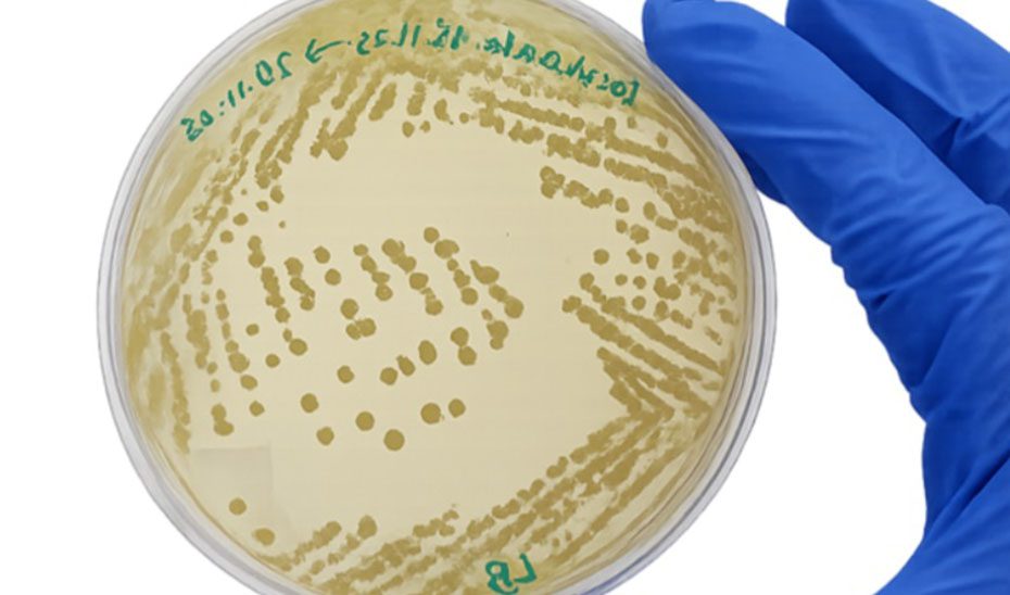 La ciencia andaluza obtiene bacterias de depuradora que eliminan en tres días el ibuprofeno de suelos agrícolas contaminados