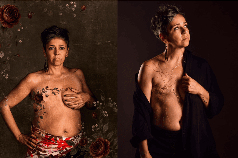 La US conmemora el Día Mundial del Cáncer de Mama con actividades de sensibilización y prevención